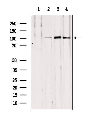 Polyclonal Rabbit anti-Human NOD2 / CARD15 Antibody (IHC, IF, WB)