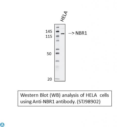 Monoclonal Mouse anti-Human NBR1 Antibody (WB)