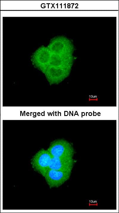 IHC-plus™ BCL2L10 / Diva Antibody (aa60-153)