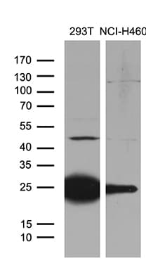 Monoclonal Mouse anti-Human TLR8 Antibody (clone OTI3A6, aa32-153, WB)