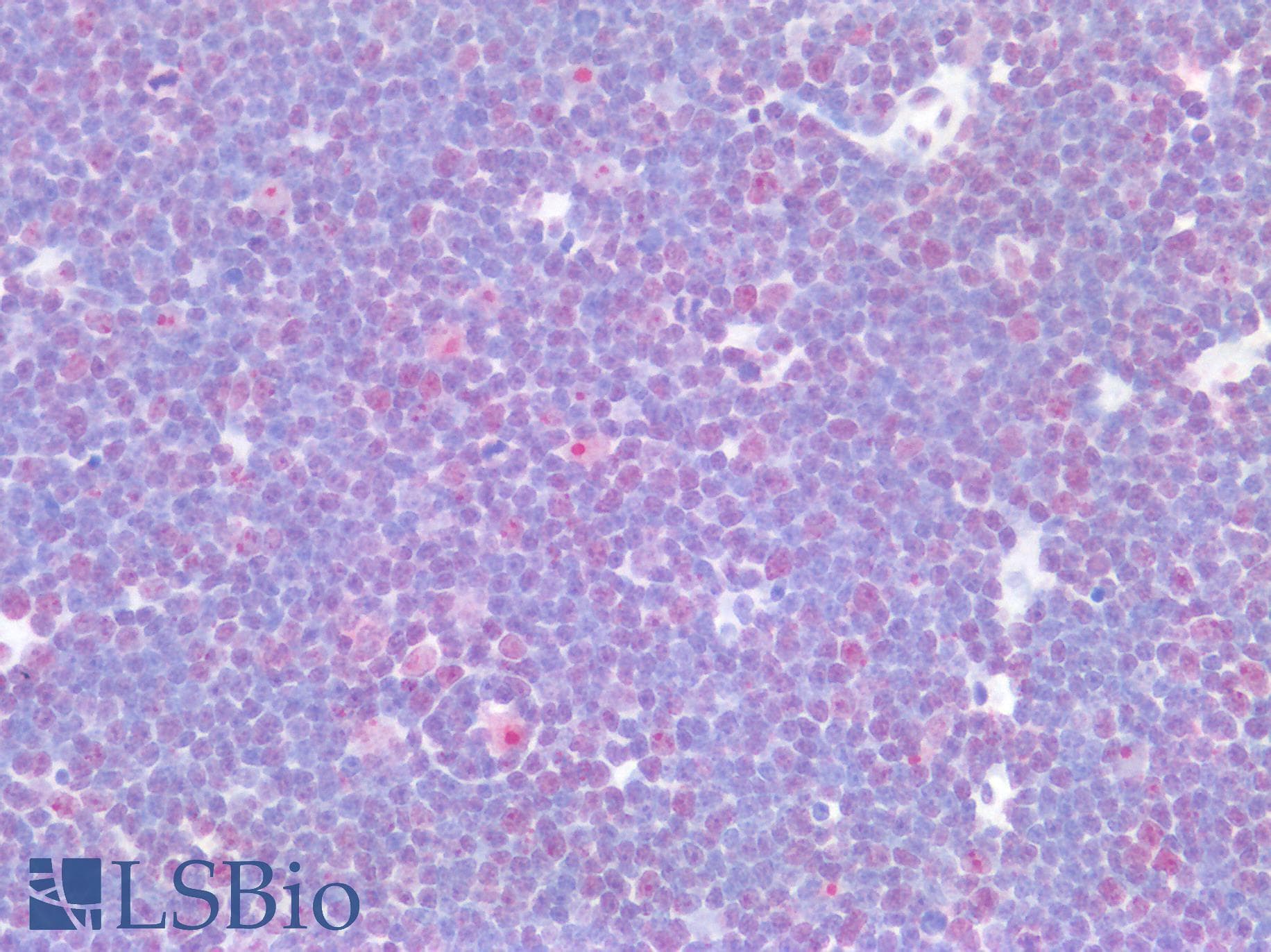 PathPlus™ Polyclonal Rabbit anti-Human CDK1 / CDC2 Antibody (aa121-170, IHC, WB)