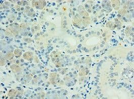 Polyclonal Rabbit anti-Human PAK6 Antibody (aa1-270, IHC)