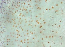 Polyclonal Rabbit anti-Human MCM6 Antibody (aa562-821, IHC)
