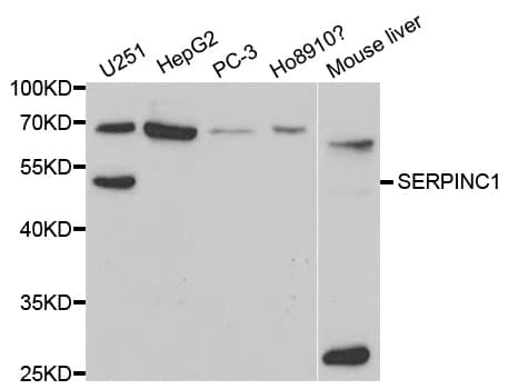Polyclonal Rabbit anti-Human Antithrombin-III Antibody (IHC, IF, WB)