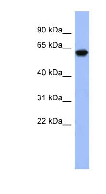 Polyclonal Rabbit anti-Human KLHL8 Antibody (N-Terminus, WB)