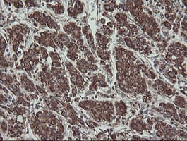 FAM164A / CGI-62 Antibody (clone OTI4C1)