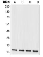 Polyclonal Rabbit anti-Human MRPL20 Antibody (C-Terminus, WB)
