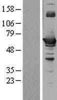 CBS Protein (Over-Expression Lysate Myc-DDK (Flag))