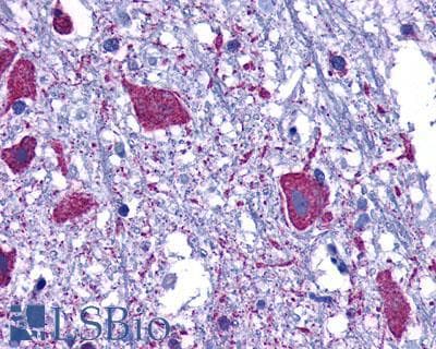 PathPlus™ Polyclonal Rabbit anti-Human ACKR3 / CXCR7 Antibody (Cytoplasmic Domain, IHC, WB)