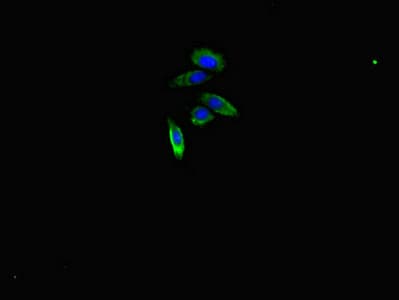 ARHGAP10 Antibody
