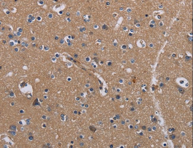 PIDD1 Antibody