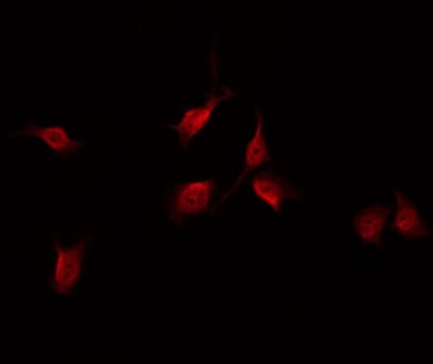 FAK / Focal Adhesion Kinase Antibody (phospho-Tyr861)