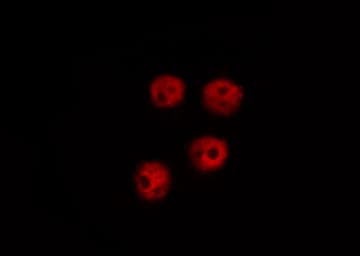 Polyclonal Rabbit anti-Human ESR2 / ER Beta Antibody (aa94-118, IHC, IF, WB)