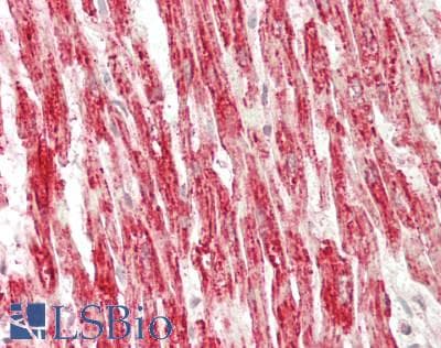 IHC-plus™ SDHA Antibody