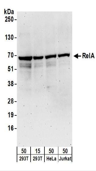 RELA / NFKB p65 Antibody (aa501-551)