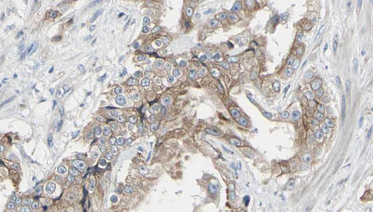Polyclonal Rabbit anti-Human GIT1 Antibody (IHC, IF, WB)