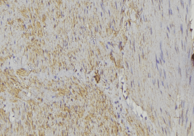 Polyclonal Rabbit anti-Human HCCS Antibody (IHC, IF, WB)