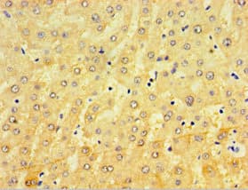 Polyclonal Rabbit anti-Human CRD / CRX Antibody (aa120-285, IHC, WB)