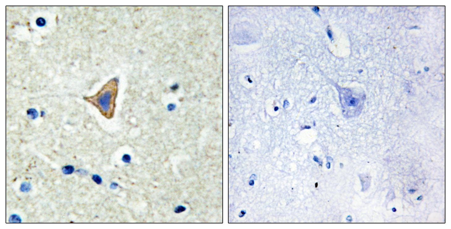 CDH20 / Cadherin 20 Antibody
