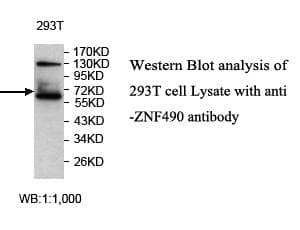 Polyclonal Rabbit anti-Human ZNF490 Antibody (aa170-459, IHC, WB)
