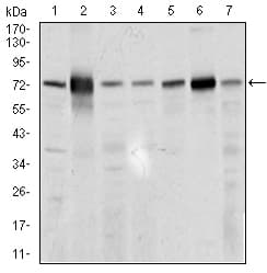 SLC27A5 / BACS Antibody (aa508-570, clone 9C4D1)