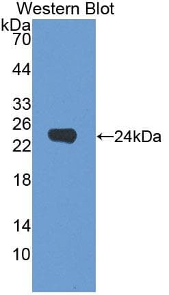 DMKN Antibody (aa27-238, Biotin)