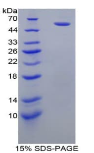 Rat FCGR3A / CD16A Protein (Recombinant His-GST)