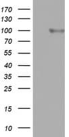 FBXO11 Antibody (aa1-300, clone OTI1E3)