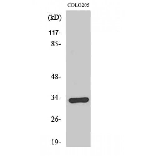 OR1B1 Antibody (130-210 aa, Internal)