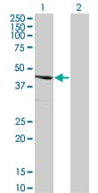 Monoclonal Mouse anti-Human SERPINE2 / Nexin Antibody (clone 3G12, WB)