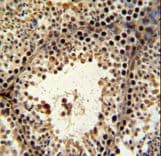 PHF13 Antibody (aa263-291)