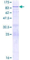 Human VPS33A Protein (Recombinant GST)