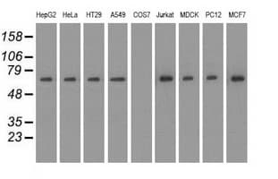 IHC-plus™ RANGAP1 Antibody (clone 1B4)