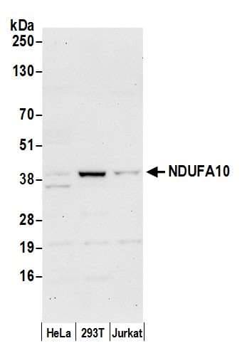 NDUFA10 Antibody (aa305-355)