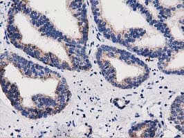 P5CR2 / PYCR2 Antibody (clone OTI5C7)