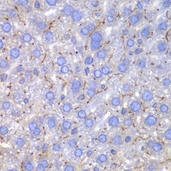 Polyclonal Rabbit anti-Human Osteonectin / SPARC Antibody (IHC, WB)