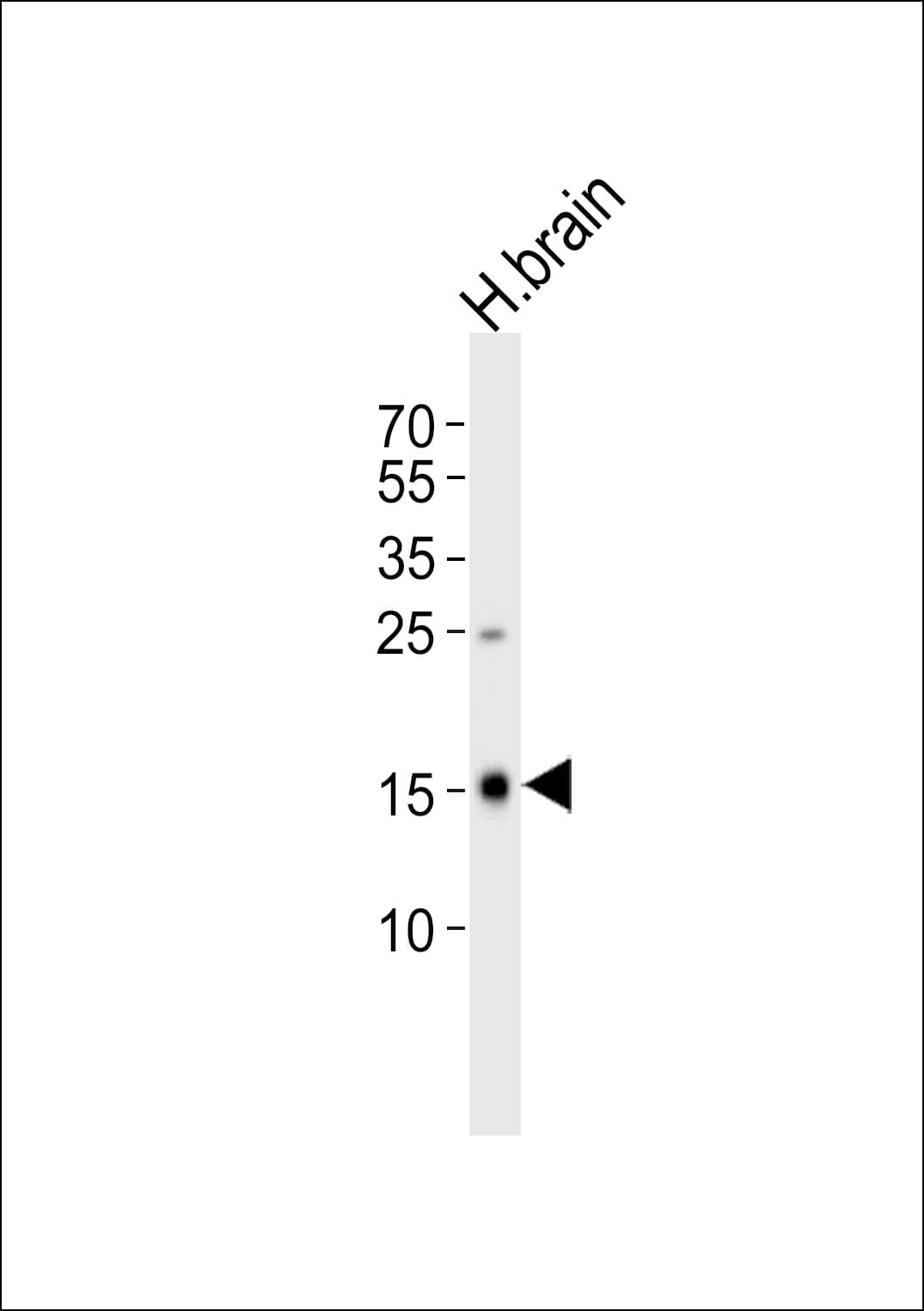 FXYD6 Antibody (aa81-115)