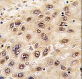 GNL3 / NS / Nucleostemin Antibody (aa458-487)
