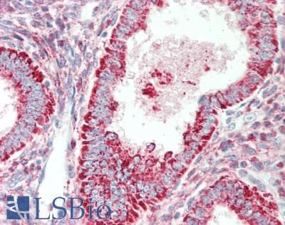 IHC-plus™ Alkaline Phosphatase Antibody