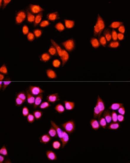 ZNF408 / PRDM17 Antibody
