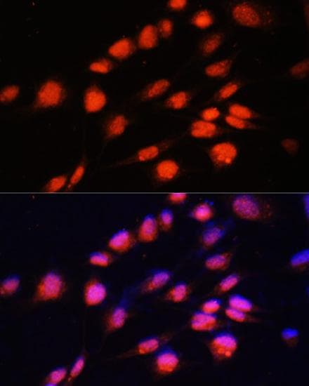 ZNF416 Antibody