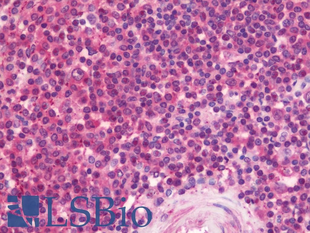 IHC-plus™ Polyclonal Rabbit anti-Human RNF114 / ZNF313 Antibody (aa1-228, IHC, WB)