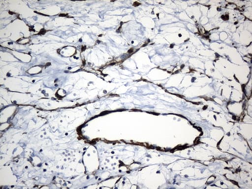 ACTA2 / Smooth Muscle Actin Antibody (N-Terminus, clone UMAB237)