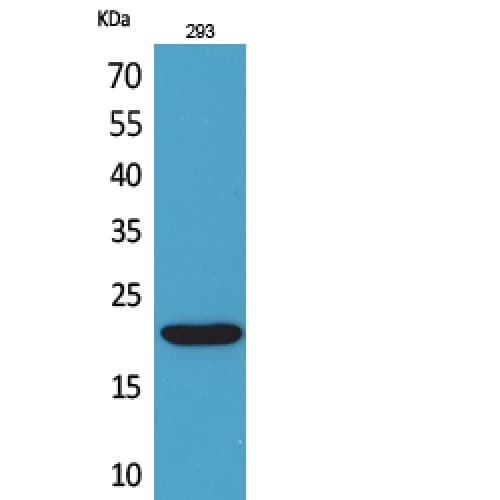CMTM6 / CKLFSF6 Antibody (131-180 aa, C-terminal)