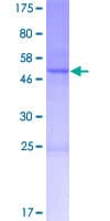 Human CNO Protein (Recombinant GST)