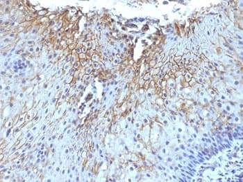 CD59 Antibody (clone SPM616)