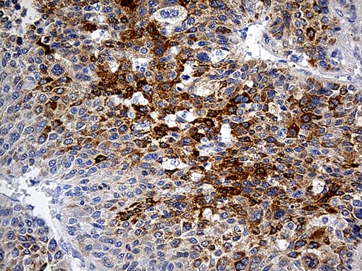 PLG / Plasmin / Plasminogen Antibody (aa301-586, clone OTI4F5)