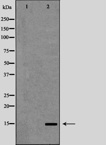 PFN1 / Profilin 1 Antibody