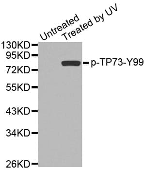 TP73 / p73 Antibody (phospho-Tyr99)
