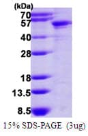 Human KRT14 / CK14 / Cytokeratin 14 Protein (Recombinant His)